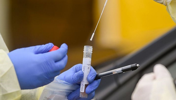 யாழ்.போதனாவில் வெளிநாடு செல்வோருக்கான பி.சி.ஆர் பரிசோதனைகள் நாளை முதல் இடைநிறுத்தம்!