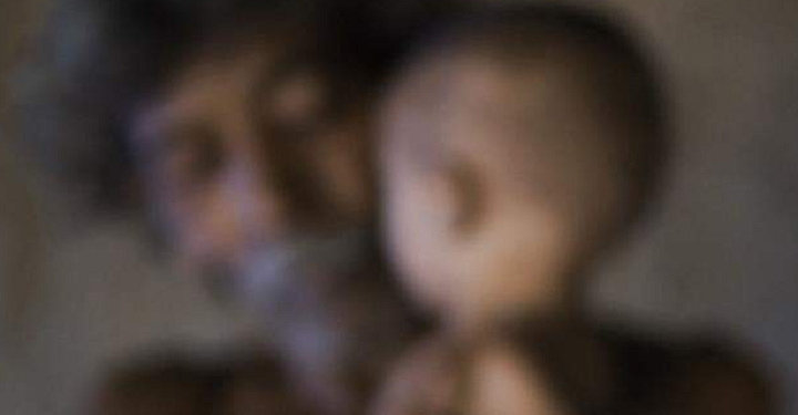 பெரும்பாலான குழந்தைகள் கடுமையான ஊட்டச்சத்து குறைபாட்டால் பாதிப்பு!