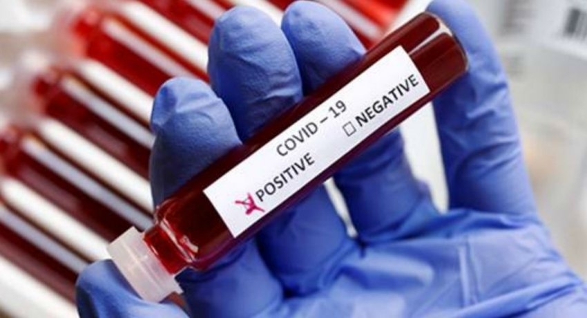 நாட்டில் கொரோனா தொற்று வீதம் அதிகரிப்பு!