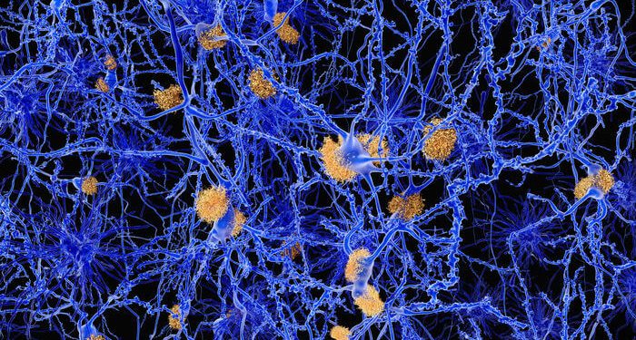 அல்சைமர் நோய்க்கான மருந்து கண்டுபிடிப்பு