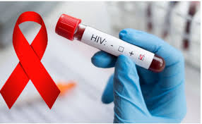 இலங்கையில் அதிகரிக்கும் எச்.ஐ.வி தொற்று!