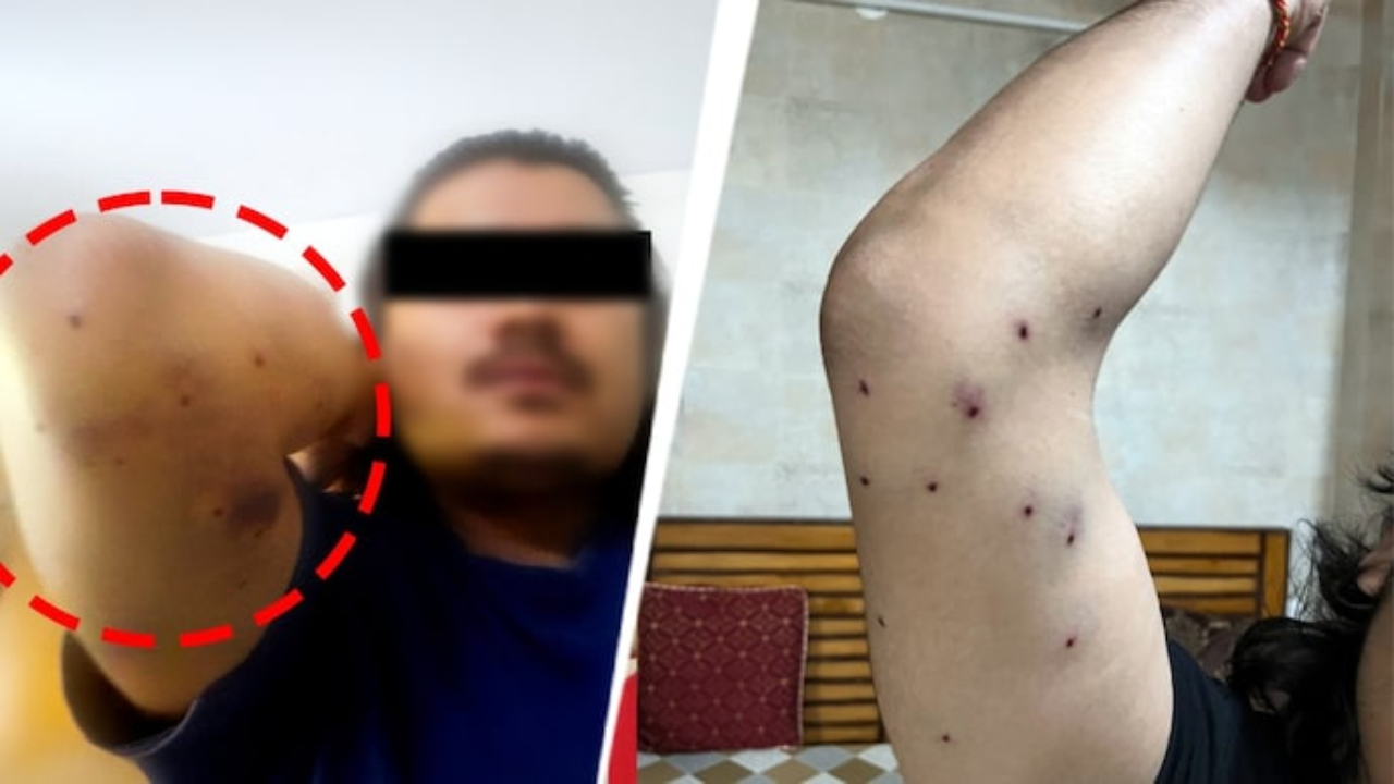 டெல்லி போராட்டம்: பெல்லட் குண்டு சர்ச்சை, களமிறங்கியது CRPF! 
